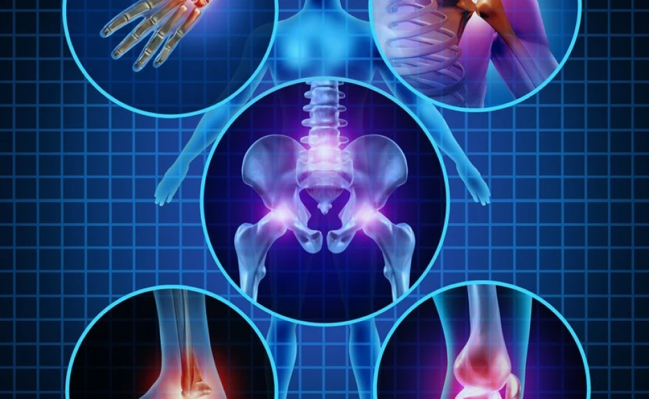 Medical illustration highlighting joints and bones affected by inflammation, focusing on the spine, hips, knees, and hands.