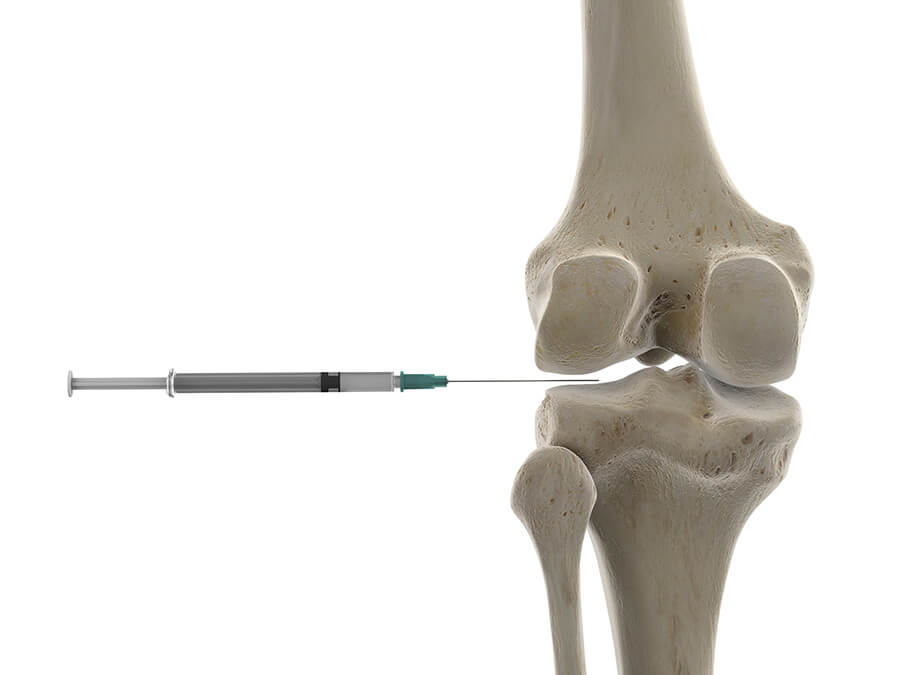 Knee injection with syringe