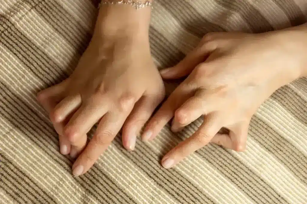 Hands displaying fingers on striped fabric