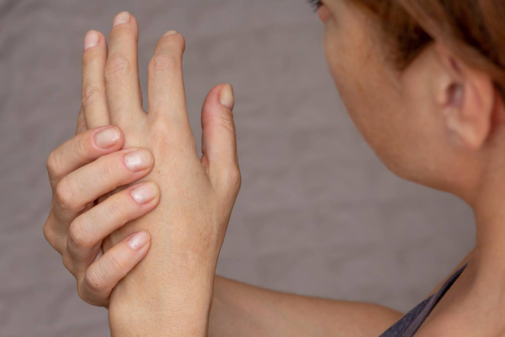 Woman rubbing her hand due to discomfort.